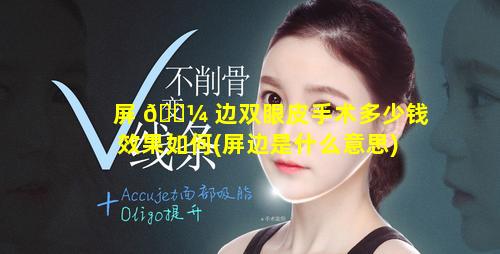 屏 🌼 边双眼皮手术多少钱效果如何(屏边是什么意思)